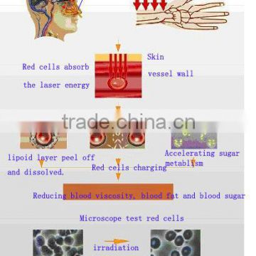 wholesale fitness product new bio laser therapy hypertention watch