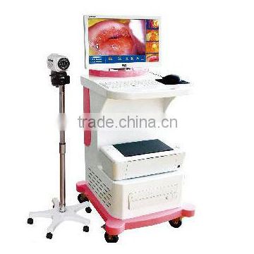 trolley video colposcope with ce