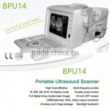 Cheapest Portable Black & White Ultrasound Machine- BPU14