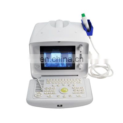 KINDLE KD-UL4  portable USB smartphone echographe ultrasound machine/probe/scanner
