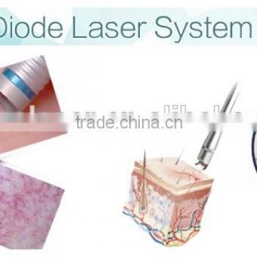 980nm diode laser surgical system medical vascular spider veins removal