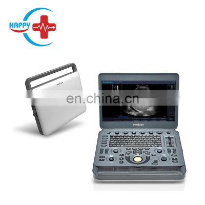 sonoscape x3 doppler ultrasound scanner ultrasound machine price cheap ultrasound machine