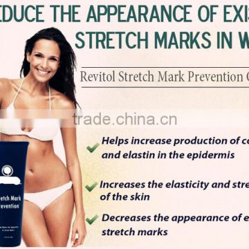 Stretch Mark Prevention Cream