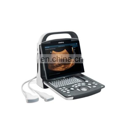 Original Mindray DP-10 B/W ultrasound system scanner Mindray DP 10 digital portable ultrasound machine device with LED screen