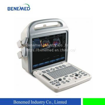 Portable Color Doppler Ultrasound Scanner BENE-3
