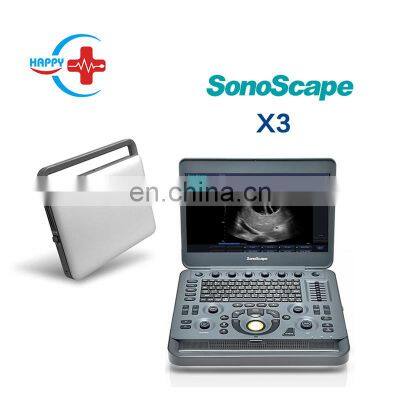 High flexibility Sonoscape ultrasound /Sonoscape x3 /Ultrasound machine portable