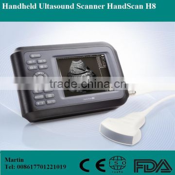 HandScan H8 portable/palm handheld ultrasonic/ ultrasound machine lower price/medical equipment