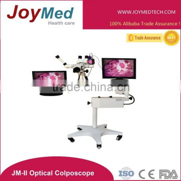 Medical Equipment Optical Binocular Colposcope with video colposcopy system
