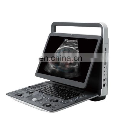Sonoscape E2pro portable color doppler ultrasound color Doppler machine with a good price
