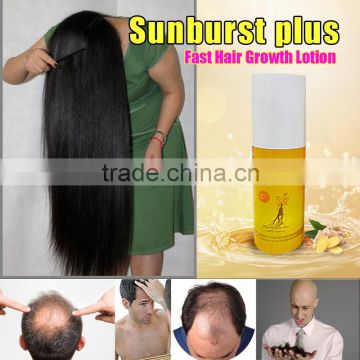 hair loss shampoo Sunburst Plus Hair Growth Lotion anti hair loss lotion
