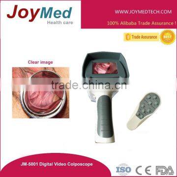 Optical/digital zoom Colposcope