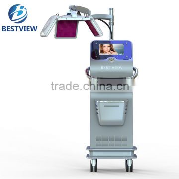 BM-666 best laser hair removal machine with super germany laser hair regrowth machine