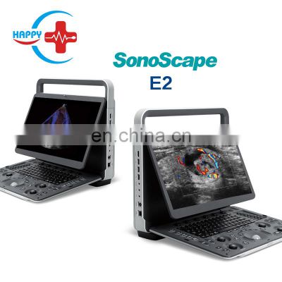 Original Sonoscape E2 Ultrasound Portable color doppler Ultrasound machine Sonoscape E2 ultrasonido