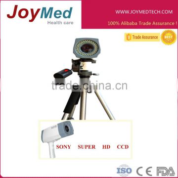 medical high pixels digital video colposcope camera