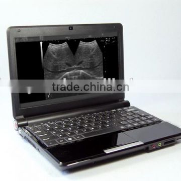 mini full digital portable laptop ultrasound for animal