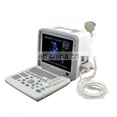 HC-A002 Factory Price Full Digital LED Portable Ultrasound pregnancy Scanner ultrasound handheld device