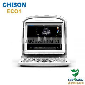 medical User-friendly and Modern Design b/w 2d portable ultrasound Chison eco1