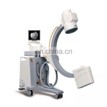 MY-D033-N High frequency 3.5KW C-arm medical x-ray machine price,xray machine