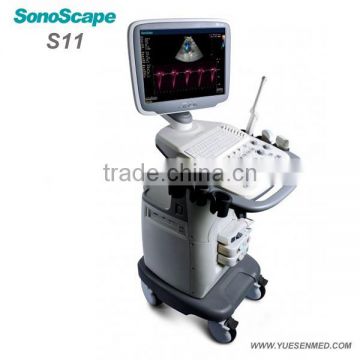 Mobile color Doppler system 3D 4D S11 Sonoscape echography