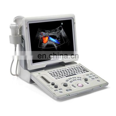 Mindray Portable ultrasound scanner/Mindray Z6 Color Doppler ultrasound machine