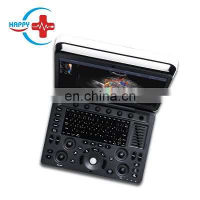 Professional laptop Ultrasound doppler/Used ultrasound machine laptop/Sonoscape e3