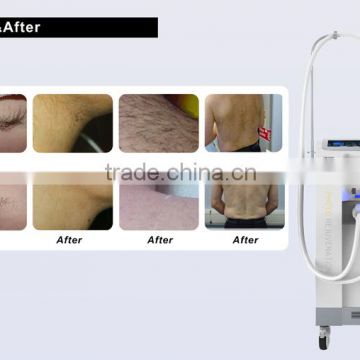Vertical Promotion Price:Headpiece SHR IPL Hair Lips Hair Removal Removal Skin Rejuvenation Beauty Device Intense Pulsed Flash Lamp