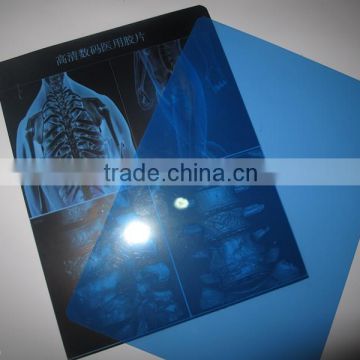 New Medical x-ray blue film thermal dry film for medical device the most popular