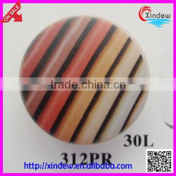 Fashion design plastic printing coat buttons/shirt buttons/High-end clothing buttons/Senior custom buttons