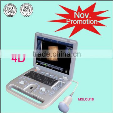(MSLCU18)3D 4D handheld Color Doppler Medical Ultrasound Scan Machine