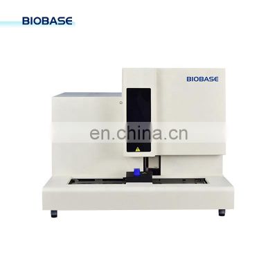 BIOBASE China Urinary Sediment Analysis System US-120 Automatic Urine Analyzer with External Printer for hospital