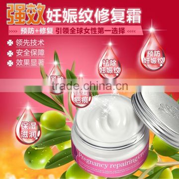 Good selling Afy Pregnancy Repairing Cream Removal stretch marks cream
