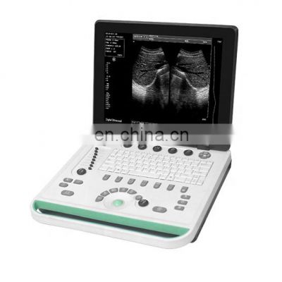 15 inch Portable Laptop Physical Therapy Medical Ultrasound Instruments Machine for Veterinary