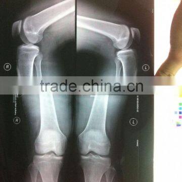 medical thermal x ray film,medical equipment dealer ,mobile lamination film