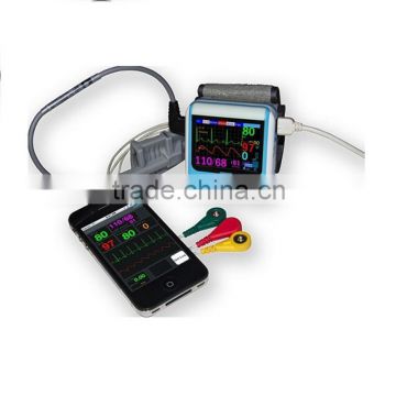 wrist ECG monitor