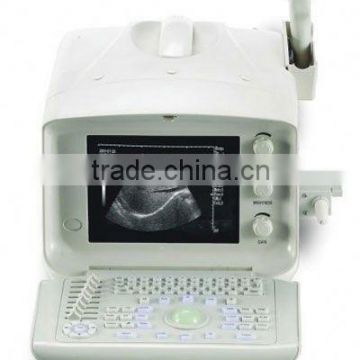 2016 ultrasound scanner for hot sale