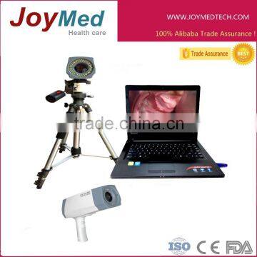 colposcope with high definition