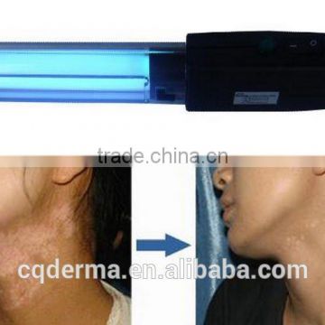 2016 bestselling UV phototherapy 311nm narrow band uvb lamp for psoriasis treatment vitiligo treatment