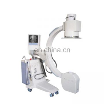 High Frequency MY-D033 Mobile C-arm System Digital x-ray machine with Factory Price