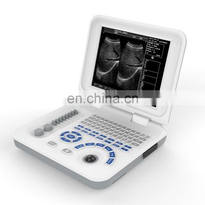 best price  scanner  handheld medical portable 10.4 inch LED laptop black and white ultrasound