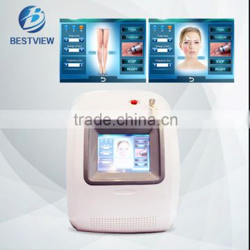 Bestview Medical 980nm laser spider vein removal with treatment video