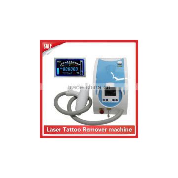 2016 high quality nd yag laser laser tattoo removal beauty Machine solon use pigment removal by q switch nd yag laser