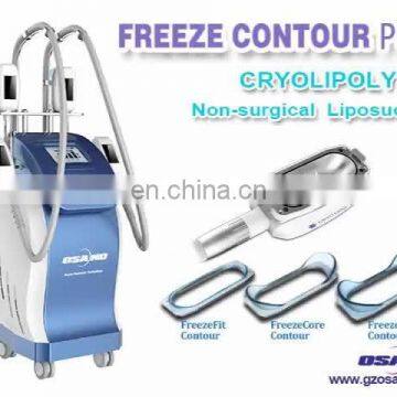 Cryotherapy Beauty For Slimming Body Cryo Liposhape Machine