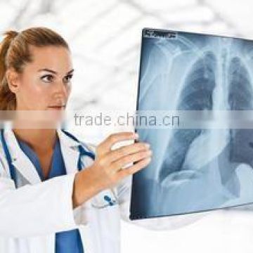 hot selling good quality Konida medical dry laser x-ray film