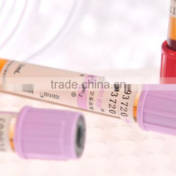 Vacuum EDTA.K2 Blood Collection Tube/EDTA.K2.Tube with CE Certificate and Good quality