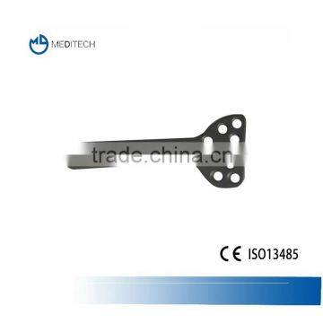 AO Standard Orthopedic Distal Radius Palm Locking Plate and Screw