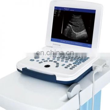 High resolution portable Ultrasonic Scanner System Full-digital Laptop Type Diagnostic Ultrasound Machine