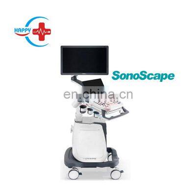 High imaging quality Sonoscape p20 doppler ultraschall /Sonoscape ultrasound machine Ultrasound scanner