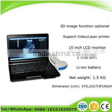 CE certified Digital Laptop Ultrasound Scanner RUS-9000F with 3.5Mhz Convex probe suitable hospital clinic