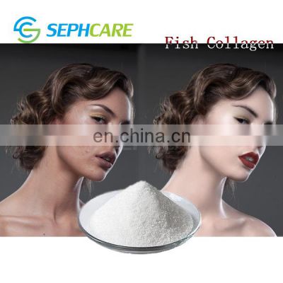 Wholesale Cosmetic Grade Collagen Hydrolyzed Fish Collagen Powder