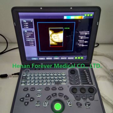Color Doppler Echography ultrasound machine